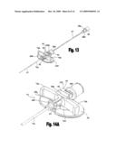 Catheter insertion apparatus and method of use thereof diagram and image