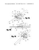 Catheter insertion apparatus and method of use thereof diagram and image