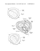 Devices, systems, and methods for reshaping a heat valve annulus diagram and image