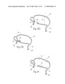 Devices, systems, and methods for reshaping a heat valve annulus diagram and image