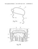 Devices, systems, and methods for reshaping a heat valve annulus diagram and image