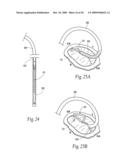 Devices, systems, and methods for reshaping a heat valve annulus diagram and image