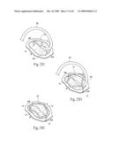 Devices, systems, and methods for reshaping a heat valve annulus diagram and image