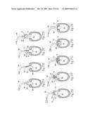 Devices, systems, and methods for reshaping a heat valve annulus diagram and image