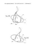 Devices, systems, and methods for reshaping a heat valve annulus diagram and image