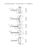 Devices, systems, and methods for reshaping a heat valve annulus diagram and image