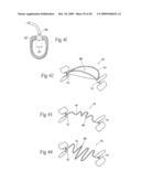 Devices, systems, and methods for reshaping a heat valve annulus diagram and image