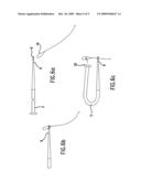 UNIVERSAL PERCUTANEOUS ENDOSCOPIC GASTROSTOMY TUBE diagram and image