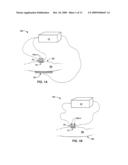 DYNAMICALLY CONTROLLABLE MULTI-ELECTRODE APPARATUS & METHODS diagram and image