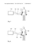 Therapy apparatus for thermal sclerosing of body tissue diagram and image