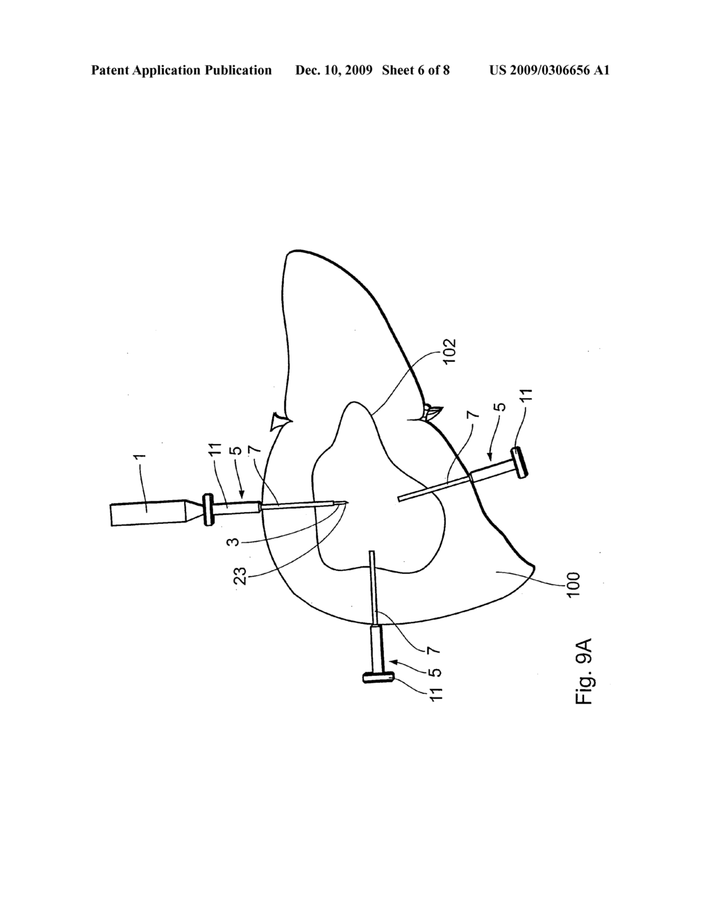 Therapy apparatus for thermal sclerosing of body tissue - diagram, schematic, and image 07