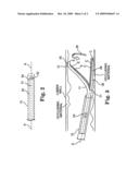 SPLIT FLEXIBLE TUBE BIASING AND DIRECTIONAL ATHERECTOMY DEVICE AND METHOD diagram and image