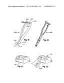 INTERSPINOUS PROCESS SPACER diagram and image