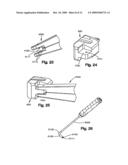 INTERSPINOUS PROCESS SPACER diagram and image