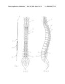 FLUID-POWERED ELONGATION INSTRUMENTATION FOR CORRECTING ORTHOPEDIC DEFORMITIES diagram and image