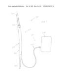 FLUID-POWERED ELONGATION INSTRUMENTATION FOR CORRECTING ORTHOPEDIC DEFORMITIES diagram and image