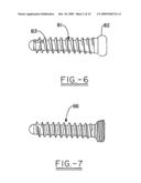 Orthopedic plates for use in clavicle repair and methods for their use diagram and image