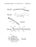 Orthopedic plates for use in clavicle repair and methods for their use diagram and image