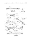 Orthopedic plates for use in clavicle repair and methods for their use diagram and image