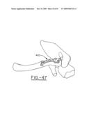 Orthopedic plates for use in clavicle repair and methods for their use diagram and image