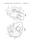 COMBINED NEURAL STIMULATION AND CARDIAC RESYNCHRONIZATION THERAPY diagram and image