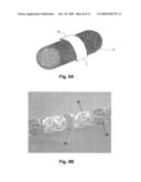 COVERING FOR AN ENDOPROSTHETIC DEVICE AND METHODS OF USING FOR ANEURYSM TREATMENT diagram and image