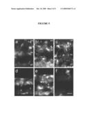 Ocular Scaffolds and Methods for Subretinal Repair of Bruch s Membrane diagram and image