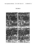 Ocular Scaffolds and Methods for Subretinal Repair of Bruch s Membrane diagram and image