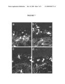 Ocular Scaffolds and Methods for Subretinal Repair of Bruch s Membrane diagram and image