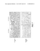 Elastase Treatment of Tissue Matrices diagram and image