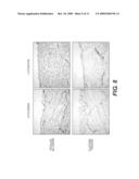 Elastase Treatment of Tissue Matrices diagram and image