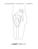 COMPLIANT IMPACT PROTECTION PAD diagram and image