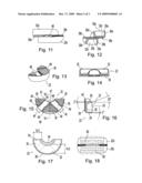 Anti-snoring device diagram and image