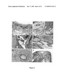 Macromolecular Delivery Systems for Non-Invasive Imaging, Evaluation and Treatment of Arthritis and Other Inflammatory Diseases diagram and image