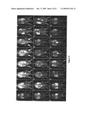 Macromolecular Delivery Systems for Non-Invasive Imaging, Evaluation and Treatment of Arthritis and Other Inflammatory Diseases diagram and image