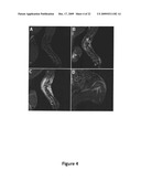 Macromolecular Delivery Systems for Non-Invasive Imaging, Evaluation and Treatment of Arthritis and Other Inflammatory Diseases diagram and image