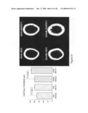 Anti-activin antibodies and uses for promoting bone growth diagram and image