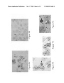 In situ detection of early stages and late stages HPV einfection diagram and image