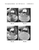 Nano-Sized Particles for Formation Fines Fixation diagram and image