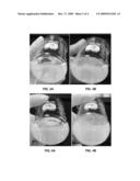 Nano-Sized Particles for Formation Fines Fixation diagram and image