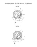 PRESSING MEMBER, ENDOSCOPIC TREATMENT SYSTEM, AND ENDOSCOPIC SUTURING DEVICE diagram and image