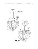 Surgical Access Methods For Use With Delicate Tissues diagram and image