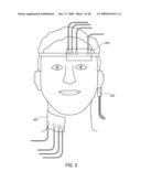 NON-INVASIVELY MONITORING BLOOD PARAMETERS diagram and image