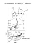 Wound treatment apparatus and method diagram and image