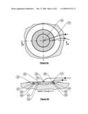 Wound treatment apparatus and method diagram and image