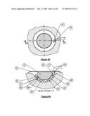 Wound treatment apparatus and method diagram and image