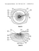 Wound treatment apparatus and method diagram and image