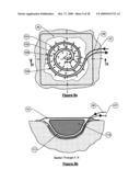 Wound treatment apparatus and method diagram and image