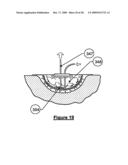 Wound treatment apparatus and method diagram and image