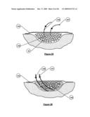 Wound treatment apparatus and method diagram and image